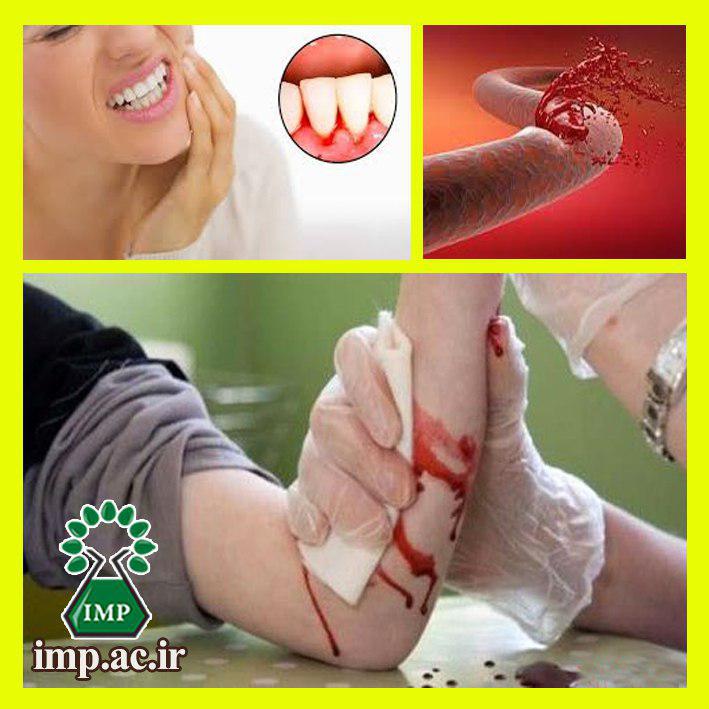 /Uploads/News/اثر گیاهان دارویی دردرمان خون ریزی های داخلی و خارجی