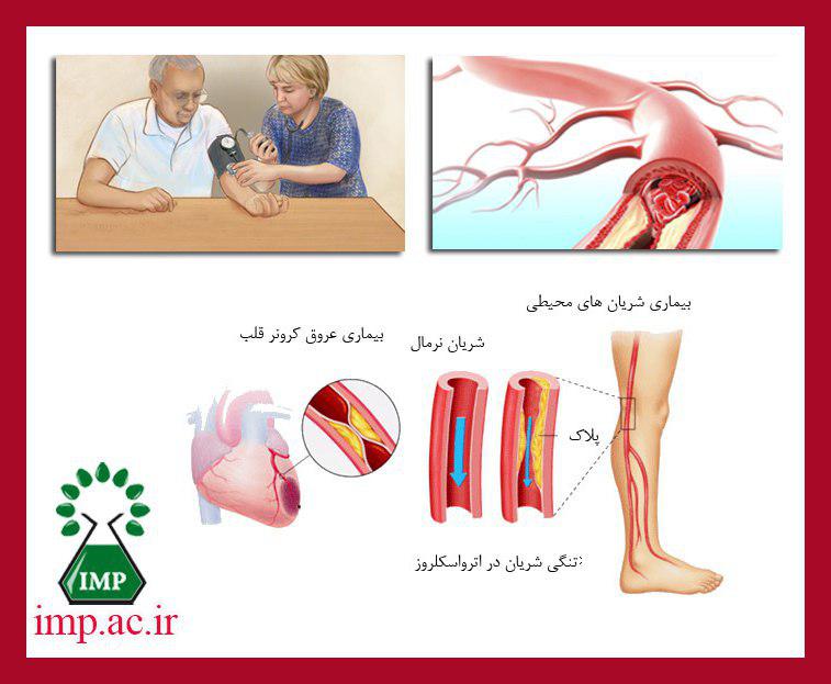 /Uploads/News/درمان آترواسکلروز با داروهای گیاهی